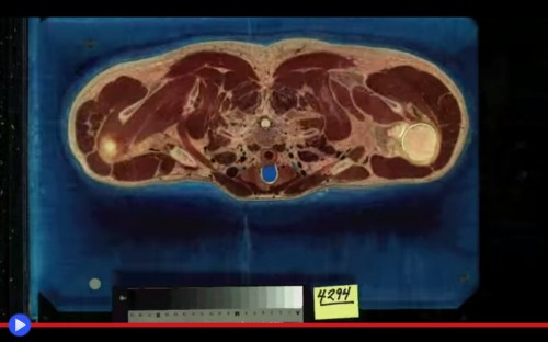 Human Cross Section